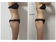 ノアリラクゼーション 難波/頭の血流促進