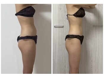 ノアリラクゼーション 難波/頭の血流促進