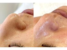 ミッシーズ(Missi:z)/美肌ケア／フェイシャルワックス