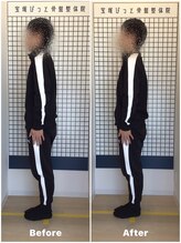 宝塚ぴっと骨盤整体院/姿勢が気になる