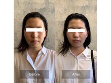 フフラ KANコルギセラピー山梨本店(fufla)の雰囲気（小顔矯正メニューBefore After）