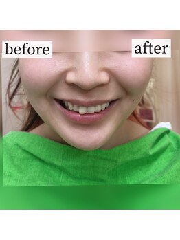 介正鍼灸整骨院つきぐま/