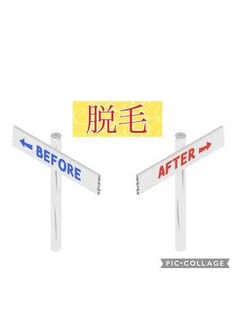 トータルケアーサロン アクア 時津(AQUA)/脱毛