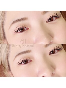 ビューティーホスピタル(Beauty Hospital)/フラットマットラッシュ140本