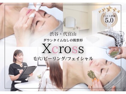 クロス(Xcross)の写真