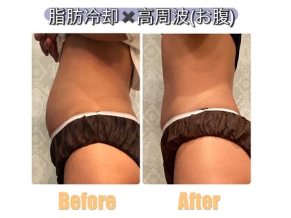 サロンドプレマージュ(Salon de Premage)の写真