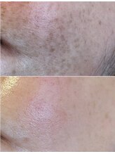 ビューティリュクス(beauty luxe)/もやもやシミも納得の仕上がり