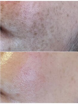 ビューティリュクス(beauty luxe)/もやもやシミも納得の仕上がり