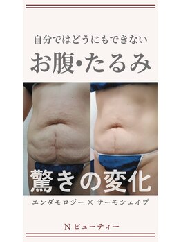 Nビューティー/最新エンダモロジーBODY