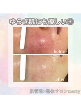 メリー 大和八木店(merry)/秋のゆらぎ肌対策！！