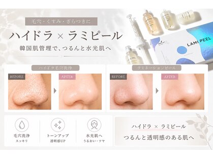 アルム 心斎橋(areum)の写真