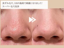 レイテノール 藤沢店
