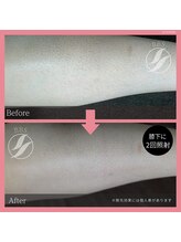 ブロンズ(BRONZE)/ひざ下