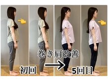 美容整体サロン 心斎橋の雰囲気（花嫁様のよくある悩み巻き肩気になるもこの変化！）