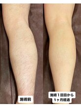 アレッド 大阪店(ared.)/今からが旬！