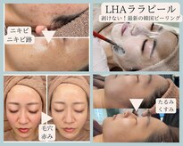 リラ 郡山店(Lilas)