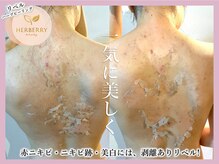 アッシュ 梅田(H)/ハーブピーリング専門Hアッシュ