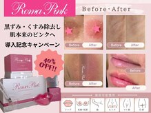 ラリール(Larire)の雰囲気（ローマピンクで全身まるごとピンクへ）