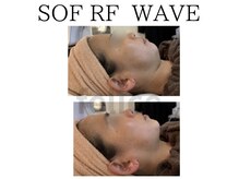 アイリー(IRIE)/ソフアールエフウェーブ