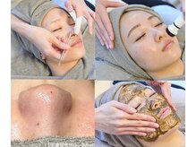 エムベル 越谷レイクタウン店(M belle)