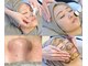 エムベル 越谷レイクタウン店(M belle)の写真/[一人ひとりに合ったお肌悩みに寄り添う]シミ・ニキビ改善専門サロン◎結果重視の本格フェイシャルサロン◆
