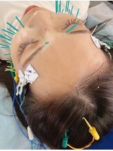 アオヤマ サロン ワイゼット(AOYAMA SALON YZ)/写真映え小顔へ