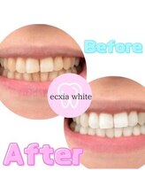 エクシアホワイト SOKA(ecxia white)/