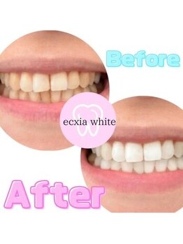 エクシアホワイト SOKA(ecxia white)/