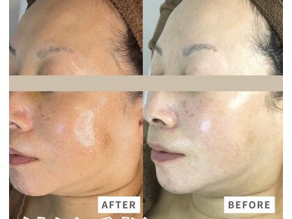 カッカ(kakka)の写真