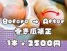 【新メニュー】フット巻爪補正　　1本【片足親指】 ¥2500