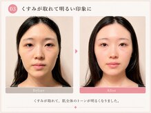 モアフェイス 池袋店(More Face)/小顔矯正・リンパ・クマ