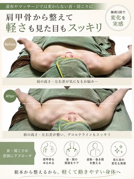スカイ(sky)の写真/湿布でごまかすのはもう終わりに。首肩こりも、見た目年齢も。土台から整える。