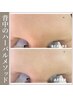 【剥離無し/ボディハーブ】背中ニキビ・二の腕のざらつき等☆ハーバルボディ