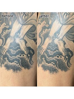 ルナソル 昭島店(LUNASOL)/WAX脱毛