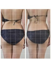 ボディメイクサロンアプローズ/冷え固まった腰肉がスッキリ