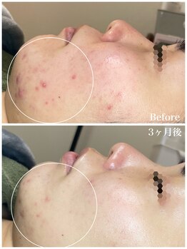 ちらちゅら/クリスティーナ　