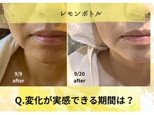 オートクチュール エステティックサロン シーズ/変化が実感できる期間は？