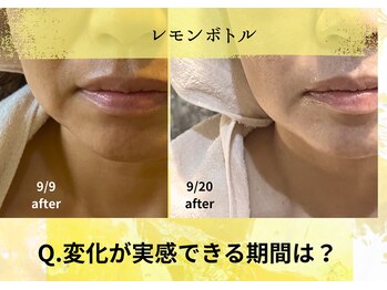 オートクチュール エステティックサロン シーズ/変化が実感できる期間は？