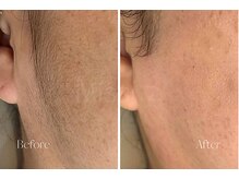 ミッシーズ(Missi:z)/くすみが気になっていませんか？