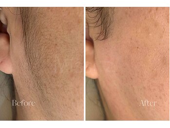 ミッシーズ(Missi:z)/くすみが気になっていませんか？