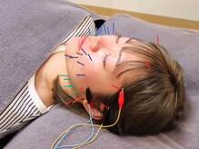 飯田橋駅前鍼灸整骨院/美容鍼【飯田橋/鍼灸】