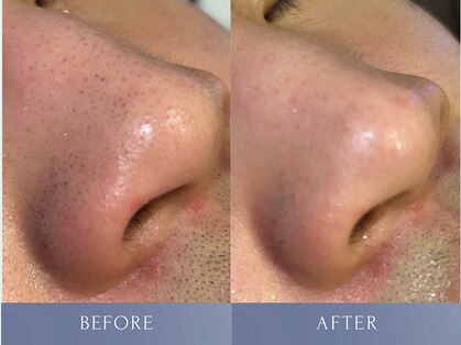 カズキ ハギワラ(Kazuki Hagiwara)の写真