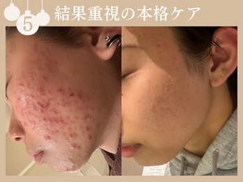 ウォーム(warm)/肌質改善のプロにお任せ下さい