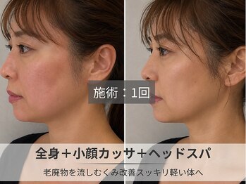 フルーブラン(Frubran)/カッサ付き全身アロマ+ヘッド