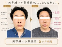 カドモリ 心斎橋(KADOMORI)の雰囲気（美容鍼/大阪美容鍼/心斎橋美容鍼/本町美容鍼/四ツ橋/小顔矯正）