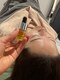 デュクレ(Beauty Clinic Ducle)の写真/【最先端の韓国肌管理メニュー導入サロン】次世代ピーリング【ラピエラピール】で毛穴縮小×リフトアップ
