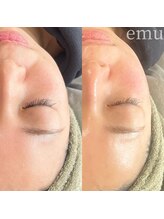 エミュ(emu)/フェイシャルwax＋emu眉毛パーマ