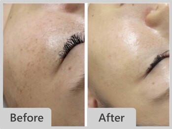 エマクラン(emmaclan)/