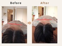 ハリデイズ/40代-顔のむくみ、たるみ