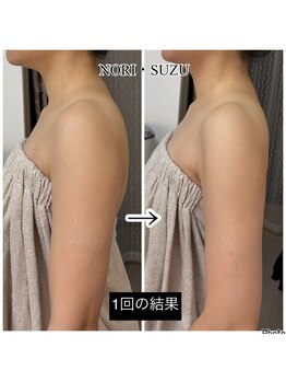 ノリスズ(NORI SUZU)/二の腕の脂肪にはレッドショット